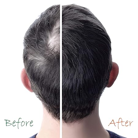 Organic Hair Energizer Hair Growth Booster with pro Vitamin B5 177ml